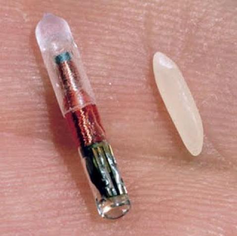 RFID Implants: adding new functionality to your body